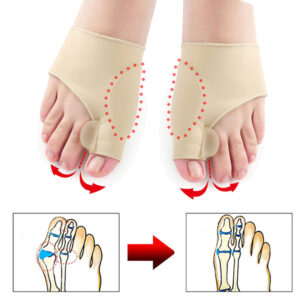 Naprava za korekcijo hallux valgus in olajšanje bolečine