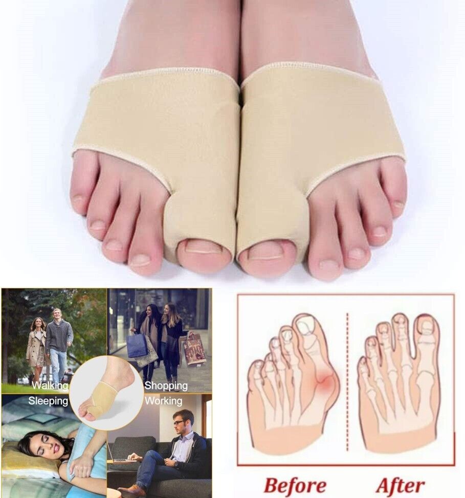 Naprava za korekcijo hallux valgus in olajšanje bolečine - Image 5