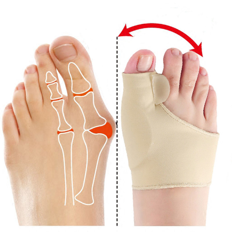 Naprava za korekcijo hallux valgus in olajšanje bolečine - Image 6